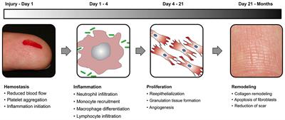 Surface Engineered Metal-Organic Frameworks (<mark class="highlighted">MOFs</mark>) Based Novel Hybrid Systems for Effective Wound Healing: A Review of Recent Developments